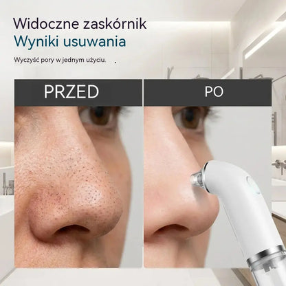 Elektryczny oczyszczacz twarzy · Ujędrnianie i lifting · Głębokie oczyszczanie porów